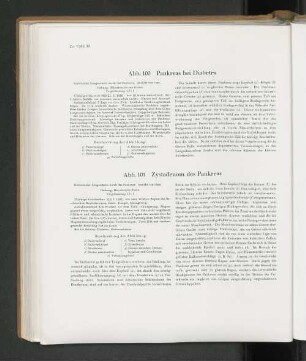 Abb. 101 Zystadenom des Pankreas