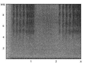Wiesengrashüpfer | Chorthippus dorsatus - Stridulation
