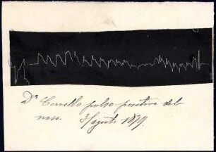 [Graphical recording (pulse), mounted on handwritten note]