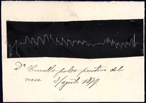 [Graphical recording (pulse), mounted on handwritten note]