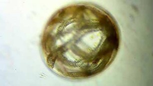 Coscinodiscus and Lagenisma Helgoland 2012