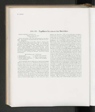Abb. 124 Papilläres Karzinom der Harnblase