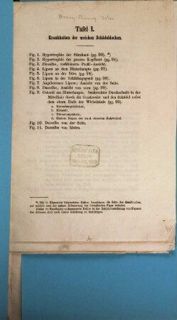 Handbuch der praktischen Chirurgie : für Ärzte und Wundärzte, [4]. [Erklärung zum chirurgischen Atlas]