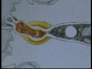 Infection of Nematodes by Conidiospores of Drechmeria coniospora