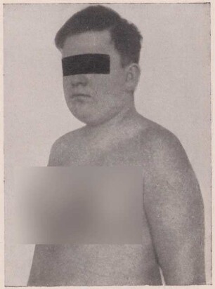 Abbildung eines Mannes mit nacktem Oberkörper