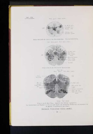 Sectiones transversae trunci cerebri.