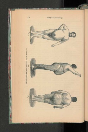Fig. 5. Hochgradig Fettleibige.