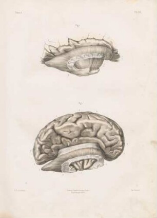 Neurologie