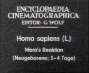 Homo sapiens - Moros Reaktion (Neugeborenes, 3 - 4 Tage)
