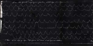 [Graphical recordings: respiration]