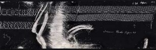 [Graphical recordings: respiration]