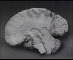 Die weiße Substanz des menschlichen Gehirns