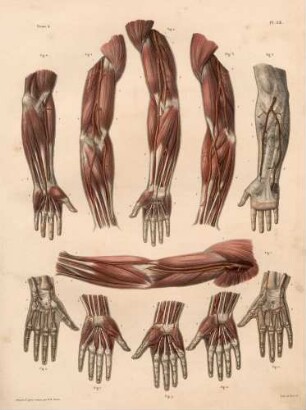 Beispiele von Anomalien der Arterien im Arm