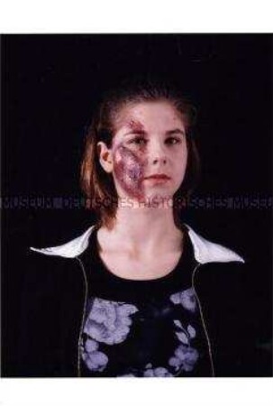 Junge Frau mit geschminkter Gesichtsverletzung (Zusätzlich eingereichtes Foto zum Sonderthema: Ein Bild von mir - Selbstporträts und Selbstdarstellungen)
