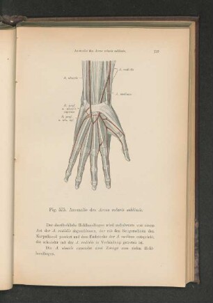 Fig. 575. Anomalie des Arcus volaris sublimis.
