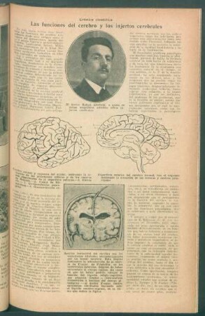 Las funciones del cerebro y los injertos cerebrales : Crónica científica