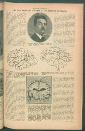Las funciones del cerebro y los injertos cerebrales : Crónica científica