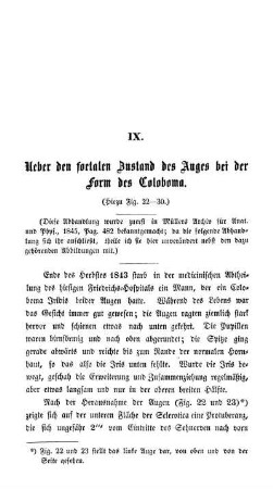 IX. Ueber den foetalen Zustand des Auges bei der Form des Coloboma