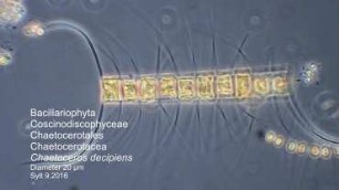 Chaetoceros decipiens Sylt 2016