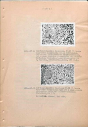 Abb. 19a: Abb. 17: Epitholoidcellige Reaktion. (Fall 3) ... Abb. 19b: Abb. 17: Epitholoidcellige Reaktion. (Fall 3) ...