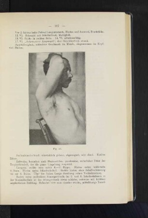 Fig. 40.
