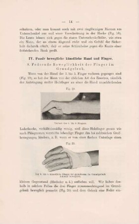 IV. Passiv bewegliche künstliche Hand und Finger