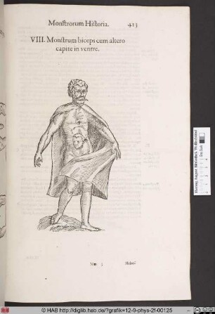 Monstrum biceps cum altero capite in ventre.