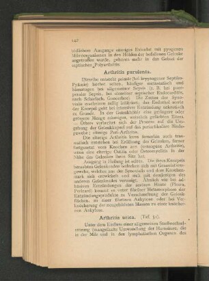 Arthritis urica. (Taf. 51).
