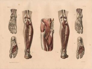 Beispiele für Anomalien der Arterien am Bein