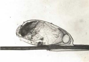 Kopflaus (Pediculus humanus capitis). Ei