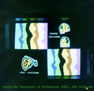 Digitale Darstellung von Szintigrammen in der Abteilung Datenverarbeitung und Instrumentierung (ADI)