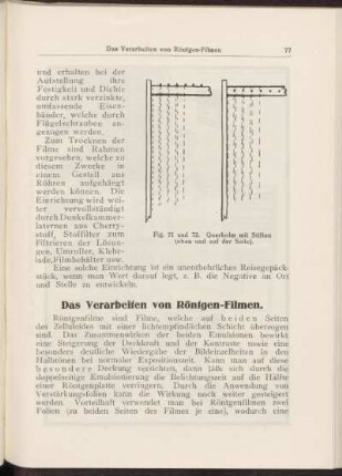 Das Verarbeiten von Röntgen-Filmen.