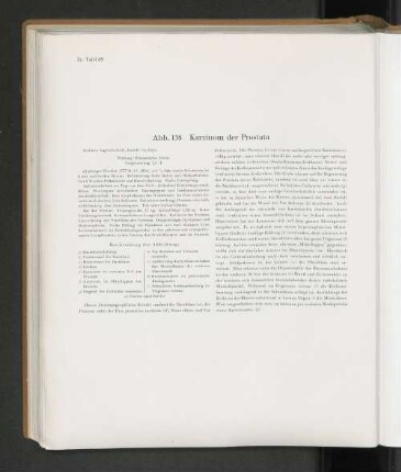 Abb. 138 Karzinom der Prostata