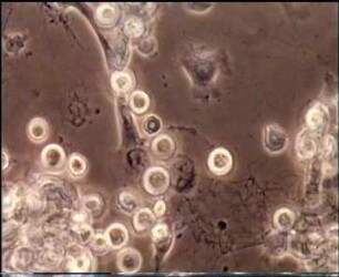 Epidermal Cell Culture - From Single Cells to Epidermal Sheets