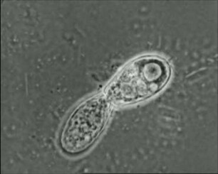 Euglypha rotunda (Testacea) - Bewegung und Fortpflanzung