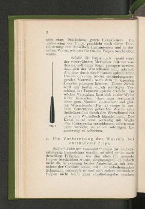 2. Die Vorbereitung der Wurzeln bei entzündeter Pulpa.