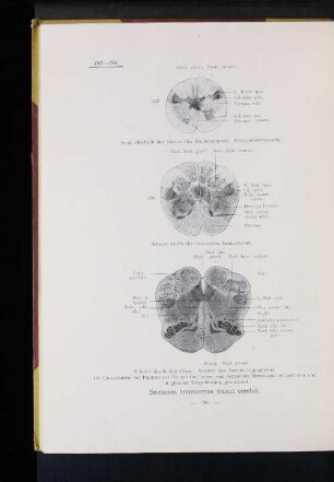 Sectiones transversae trunci cerebri.