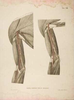 Abweichungen der tiefen Armpulsader und der seitlichen Arterie des Ellenbogens