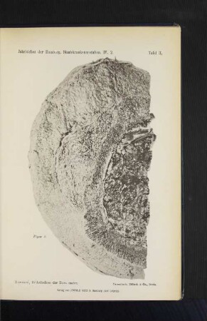 Tafel II. Roemer, Endotheliom der Dura mater.