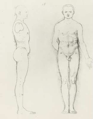Mann seitlich und von vorn : Dresdner Skizzenbuch (1507/1528). Mann seitlich und von vorn (aus: R. Bruck: Das Skizzenbuch von Albrecht Dürer, Straßburg 1905, Tafel 24, Blatt 106r, Str. 71, Kriegsverlust). Dresden: SLUB Mscr.Dresd.R.147.f