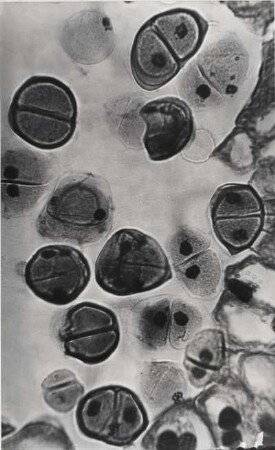 Zellteilung in der Blüte einer Lilie, ca. 1000-fach vergrößert, Mikrofotografie