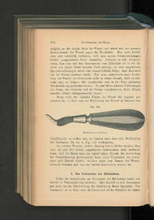 6. Die Extraction der Milchzähne.