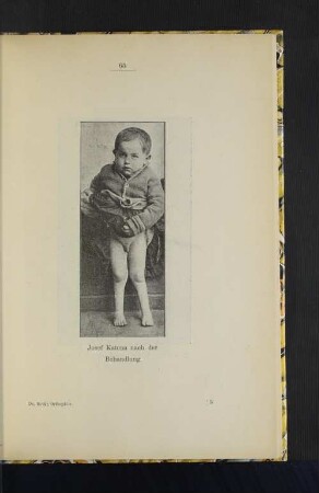 Josef Katona nach der Behandlung.