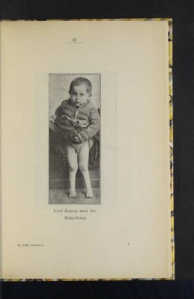 Josef Katona nach der Behandlung.