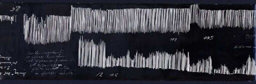 [Graphical recordings: fatigue]
