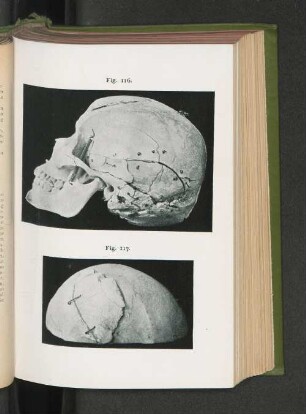 Fig. 116. Fig. 117.