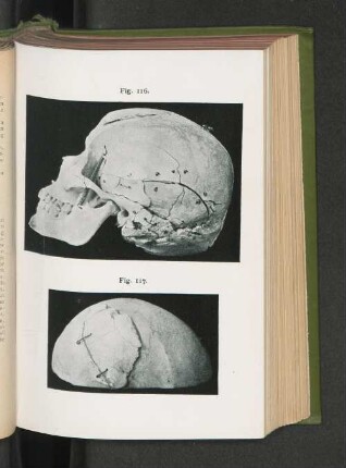 Fig. 116. Fig. 117.