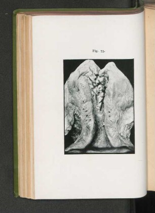 Fig. 75.