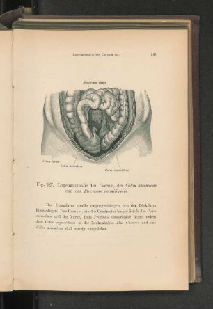 Fig. 327. Lageanomalie des Caecum etc.