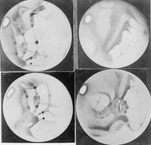 Mars, 20. IX. 1909 : Technikgeschichte | Astronomie | Planeten